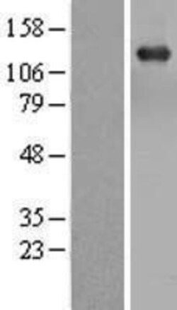 Novus Biologicals&trade;&nbsp;TBC1D1 Overexpression Lysate
