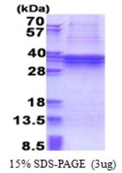 Novus Biologicals&trade;&nbsp;Recombinant Human TBC1D1 His Protein