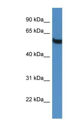 TBC1D10A Antibody, Novus Biologicals 100&mu;L; Unlabeled:Antibodies, Polyclonal