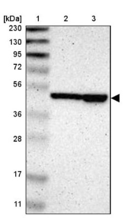 TBC1D10A Antibody, Novus Biologicals 0.1mL; Unlabeled:Antibodies, Polyclonal