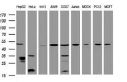 TBC1D13 Antibody (OTI2C5), Novus Biologicals 0.1mL; Unlabeled:Antibodies,