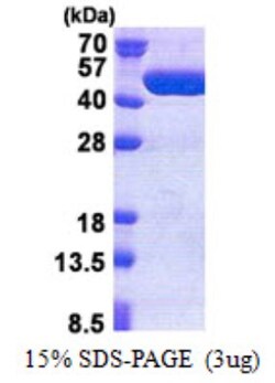 Novus Biologicals&trade;&nbsp;Recombinant Human TBC1D13 His Protein