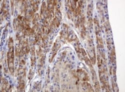 TBC1D13 Antibody (OTI2C5), Novus Biologicals 0.1mL; Unlabeled:Antibodies,
