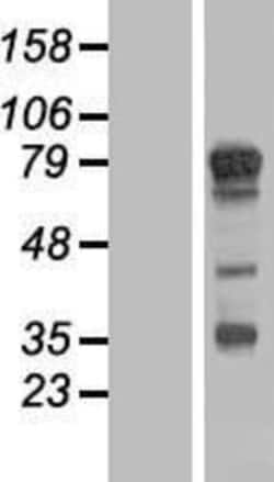 Novus Biologicals&trade;&nbsp;TBC1D14 Overexpression Lysate
