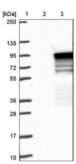TBC1D14 Antibody, Novus Biologicals:Antibodies:Primary Antibodies