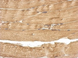 TBC1D15 Antibody, Novus Biologicals 0.1mL; Unlabeled:Antibodies, Polyclonal