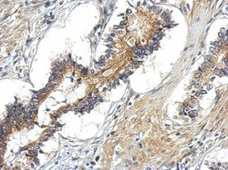 TBC1D15 Antibody, Novus Biologicals 0.1mL; Unlabeled:Antibodies, Polyclonal