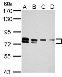 TBC1D15 Antibody, Novus Biologicals 0.1mL; Unlabeled:Antibodies, Polyclonal