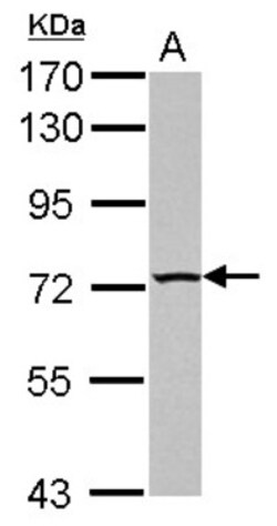 TBC1D15 Antibody, Novus Biologicals 0.1mL; Unlabeled:Antibodies, Polyclonal