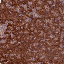 TBC1D19 Antibody, Novus Biologicals:Antibodies:Primary Antibodies