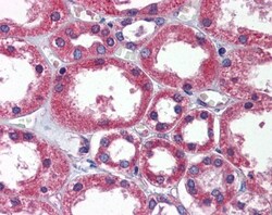 TBC1D1 Antibody, Novus Biologicals 0.05mg; Unlabeled:Antibodies, Polyclonal