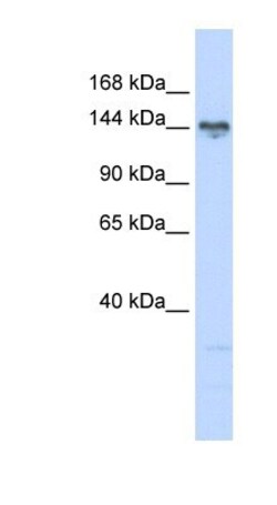 TBC1D1 Antibody, Novus Biologicals 0.05mg; Unlabeled:Antibodies, Polyclonal