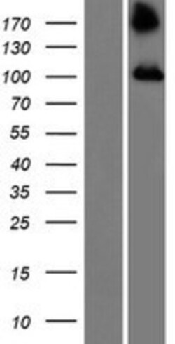 Novus Biologicals&trade;&nbsp;TBC1D2 Overexpression Lysate