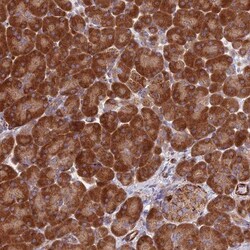 TBC1D20 Antibody, Novus Biologicals 0.1mL; Unlabeled:Antibodies, Polyclonal