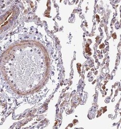 TBC1D20 Antibody, Novus Biologicals 0.1mL; Unlabeled:Antibodies, Polyclonal