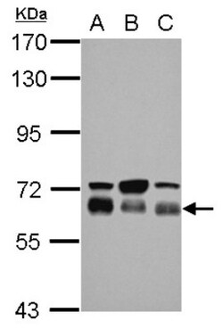 TBC1D22A Antibody, Novus Biologicals 0.1mL; Unlabeled:Antibodies, Polyclonal