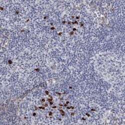 TBC1D22B Antibody, Novus Biologicals 0.1mL; Unlabeled:Antibodies, Polyclonal