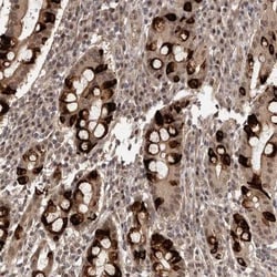 TBC1D22B Antibody, Novus Biologicals:Antibodies:Primary Antibodies