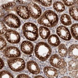 TBC1D22B Antibody, Novus Biologicals 25 &mu;L | Buy Online | Novus Biologicals | Fisher Scientific