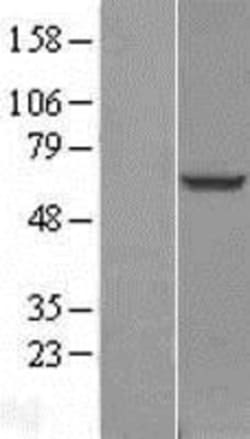 Novus Biologicals&trade;&nbsp;TBC1D24 Overexpression Lysate