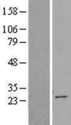 Novus Biologicals&trade;&nbsp;TBC1D28 Overexpression Lysate