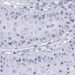 TBC1D29 Antibody, Novus Biologicals 25 &mu;L, Unlabeled:Antibodies, Polyclonal