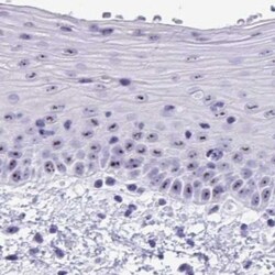 TBC1D29 Antibody, Novus Biologicals 25 &mu;L, Unlabeled:Antibodies, Polyclonal