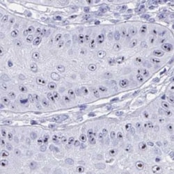 TBC1D29 Antibody, Novus Biologicals 25 &mu;L, Unlabeled:Antibodies, Polyclonal