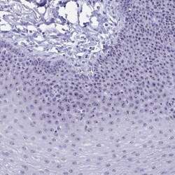 TBC1D29 Antibody, Novus Biologicals 25 &mu;L, Unlabeled:Antibodies, Polyclonal