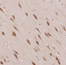 TBC1D2B Antibody, Novus Biologicals 0.1mL; Unlabeled:Antibodies, Polyclonal