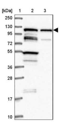 TBC1D2B Antibody, Novus Biologicals 0.1mL; Unlabeled:Antibodies, Polyclonal