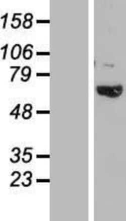 Novus Biologicals&trade;&nbsp;TBC1D3B Overexpression Lysate