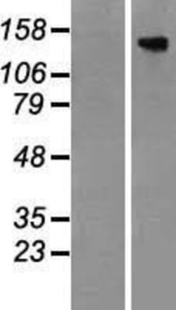 R&D Systems&trade;&nbsp;TBC1D4 Overexpression Lysate