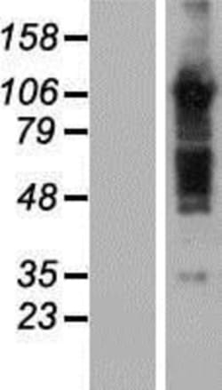 Novus Biologicals&trade;&nbsp;TBC1D5 Overexpression Lysate