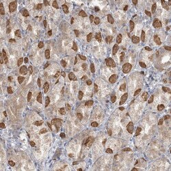 TBC1D5 Antibody, Novus Biologicals:Antibodies:Primary Antibodies