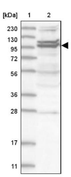 TBC1D5 Antibody, Novus Biologicals:Antibodies:Primary Antibodies