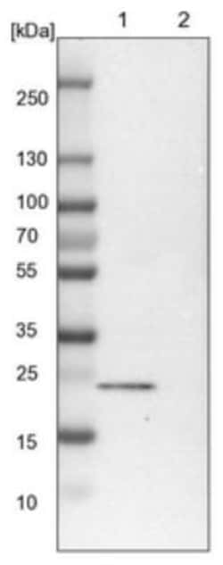 TBC1D7 Antibody, Novus Biologicals:Antibodies:Primary Antibodies