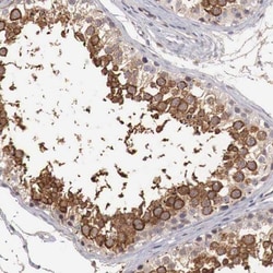 TBC1D9 Antibody, Novus Biologicals:Antibodies:Primary Antibodies
