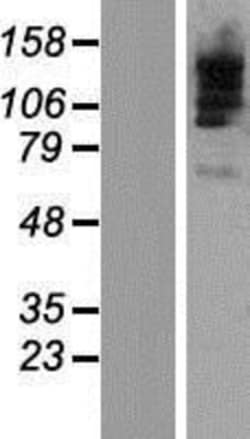 Novus Biologicals™ TBC1D9B Overexpression Lysate