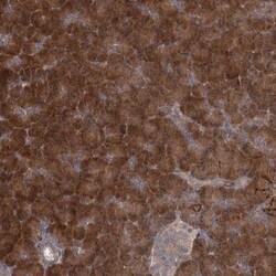 TBC1D9B Antibody, Novus Biologicals 0.1mL; Unlabeled:Antibodies, Polyclonal