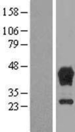 Novus Biologicals&trade;&nbsp;TBCC Overexpression Lysate