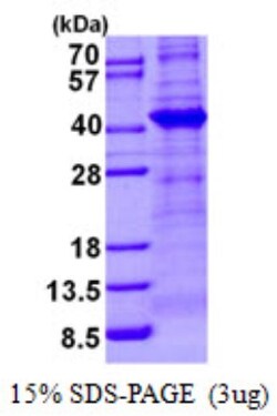 Novus Biologicals&trade;&nbsp;Recombinant Human TBCC His Protein