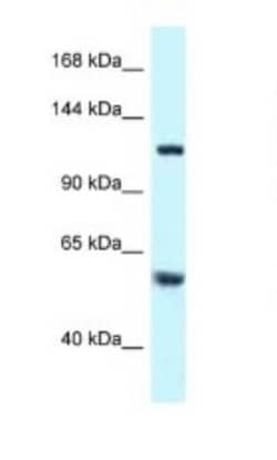 TBCD Antibody, Novus Biologicals 20&mu;L; Unlabeled:Antibodies, Polyclonal