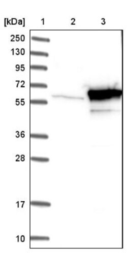 TBCE Antibody, Novus Biologicals:Antibodies:Primary Antibodies