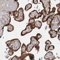 TBCE Antibody, Novus Biologicals:Antibodies:Primary Antibodies