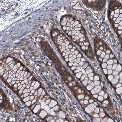 TBCK Antibody, Novus Biologicals 0.1mL; Unlabeled:Antibodies, Polyclonal