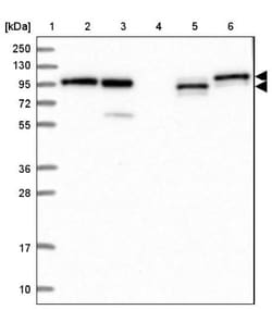 TBCK Antibody, Novus Biologicals 0.1mL; Unlabeled:Antibodies, Polyclonal