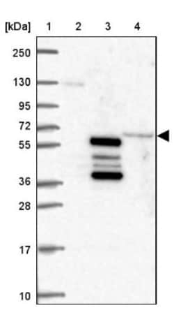 TBKBP1 Antibody, Novus Biologicals 0.1mL; Unlabeled:Antibodies, Polyclonal