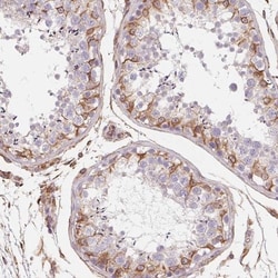 TBKBP1 Antibody, Novus Biologicals 0.1mL; Unlabeled:Antibodies, Polyclonal