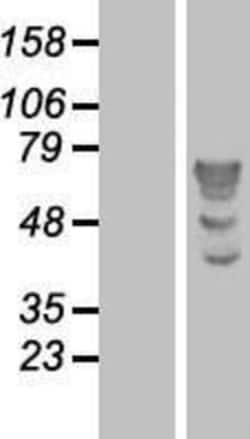 Novus Biologicals&trade;&nbsp;TBL1 Overexpression Lysate